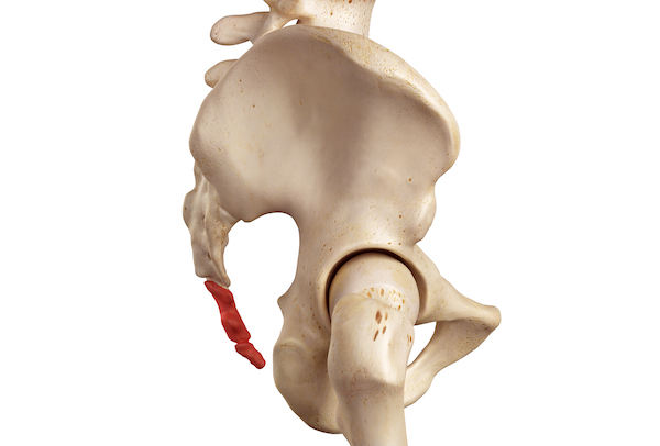 Coccyx Fracture