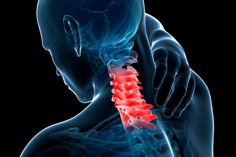 Cranio-Cervical Instability