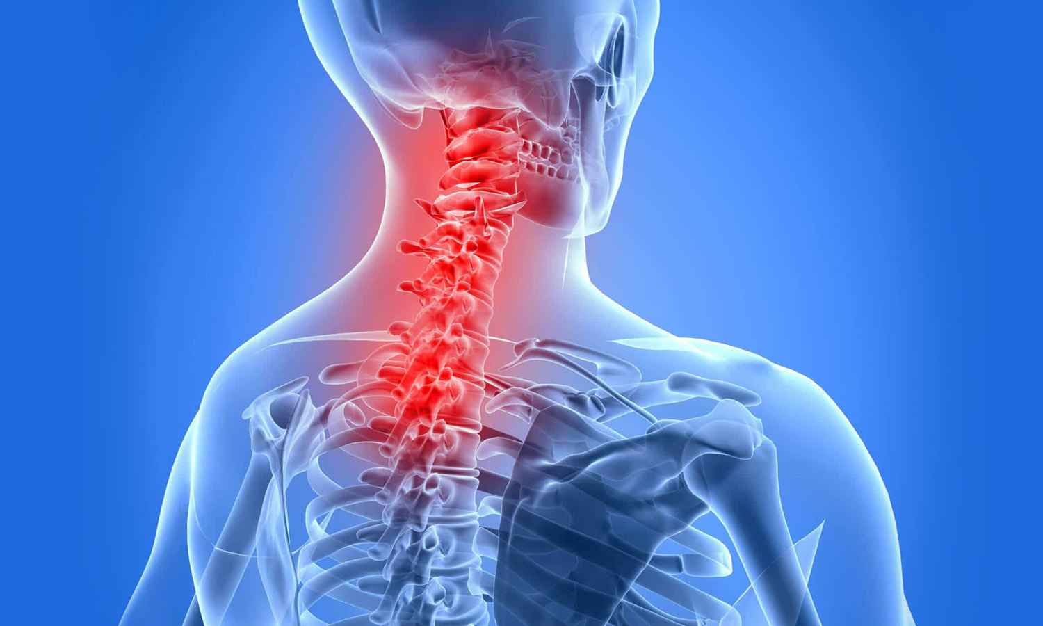 Spondylitis / Spondylosis