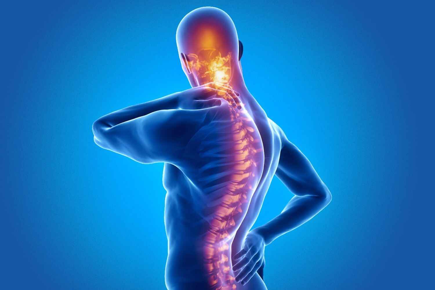 Ankylosing Spondylitis