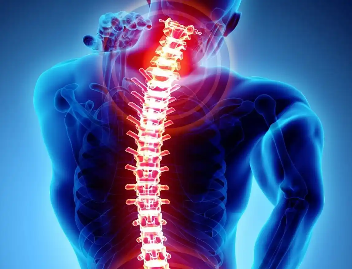 Spondylolisthesis