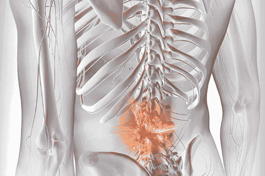 Treatment Options of Facet Joint Replacement