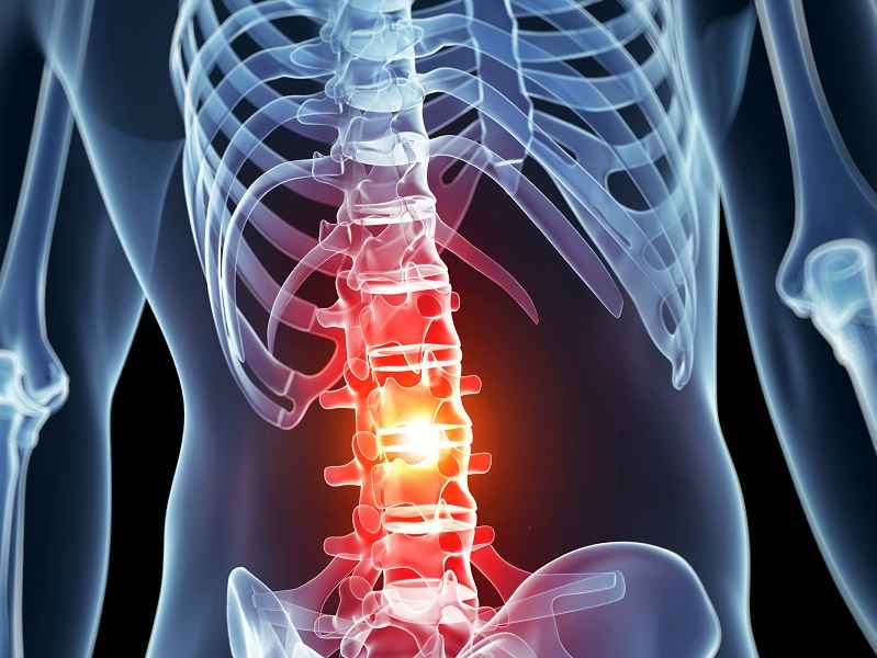 Treatment Options of Spine Trauma