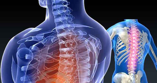 Risks of Minimally Invasive Spinal Surgery