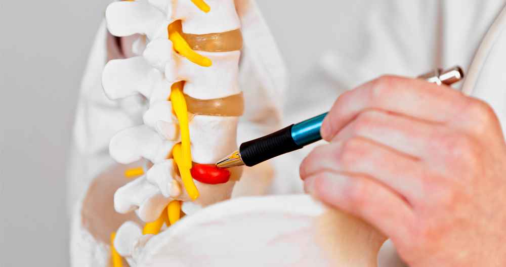 Diagnosis of Spine Trauma