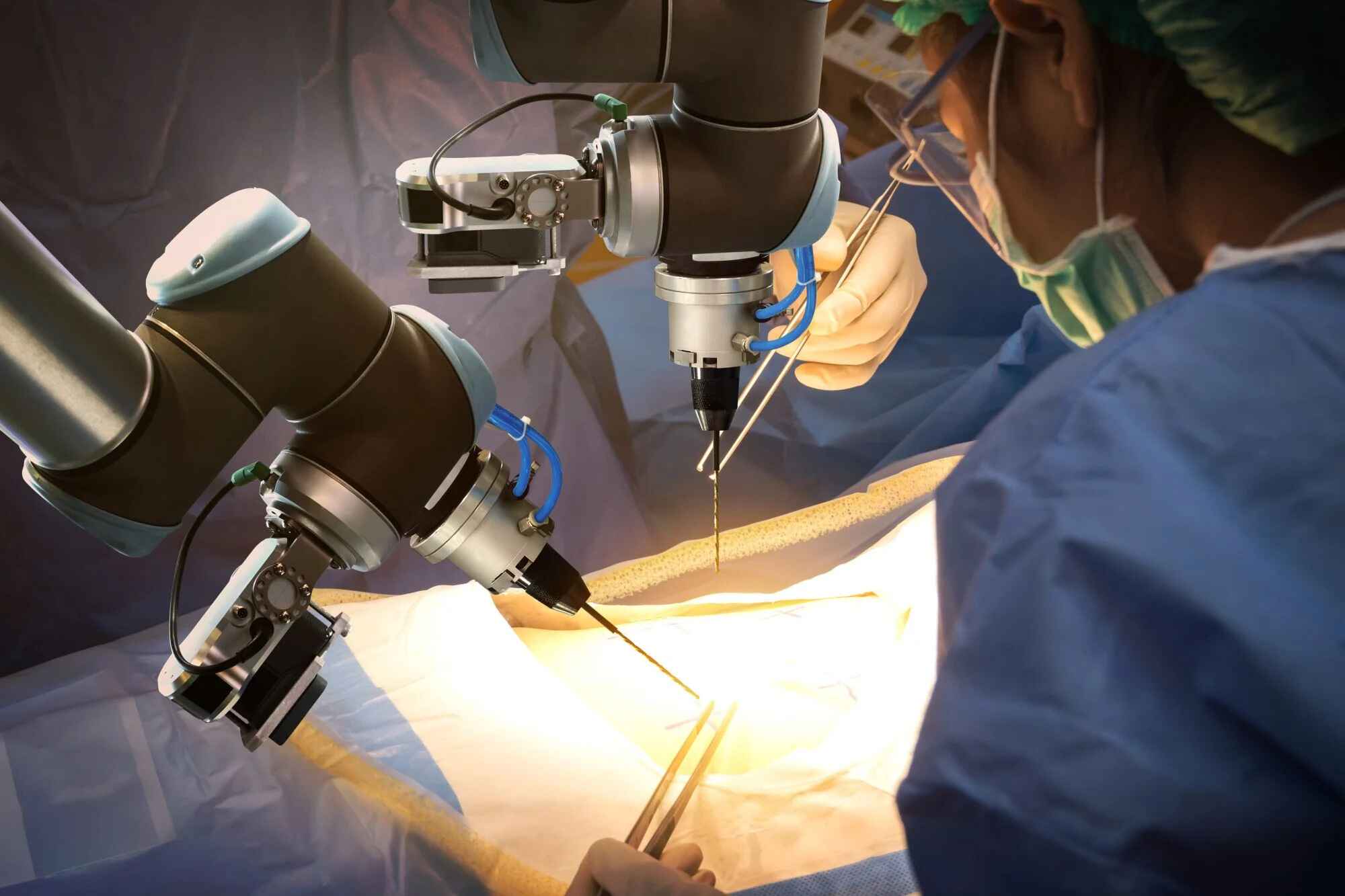 Robotic Spinal Fusion Surgery