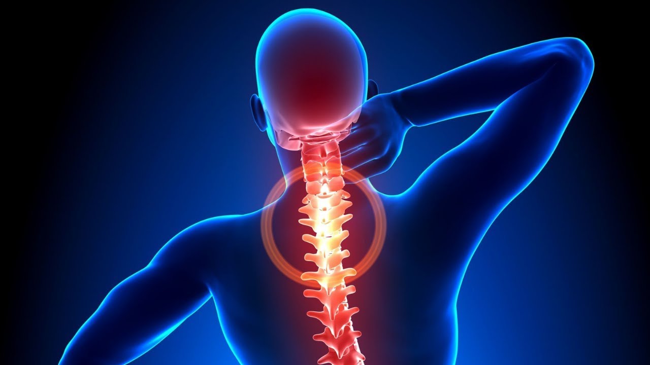 What is Failed Back Surgery Syndrome (FBSS)?