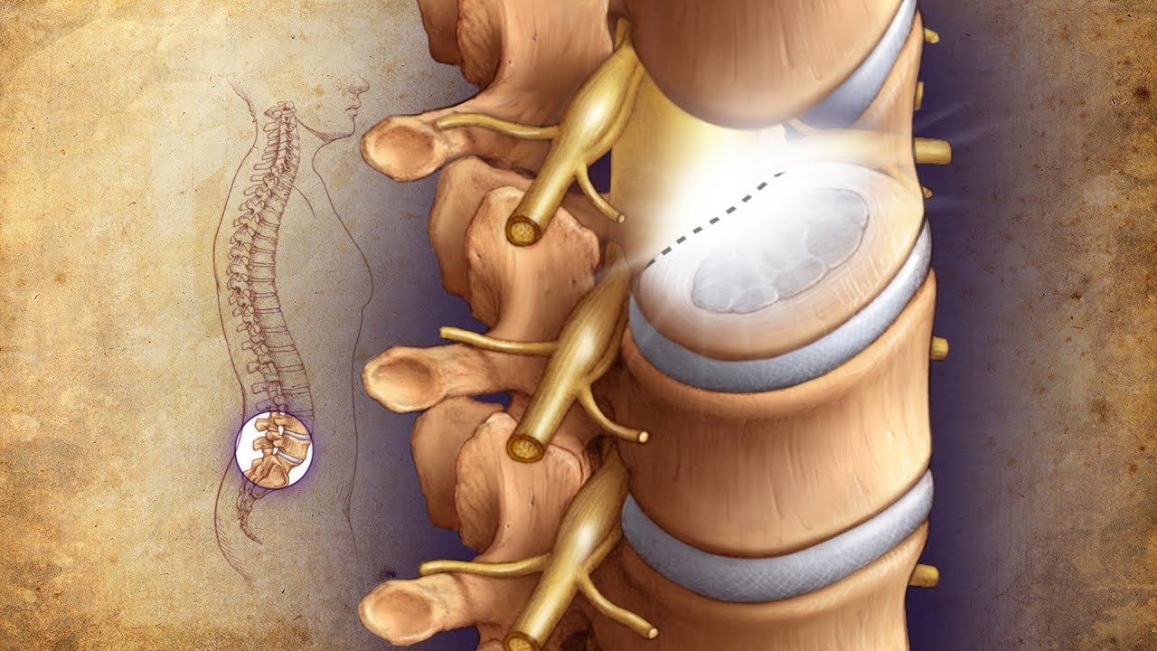 Understanding Complex Spinal Reconstructions