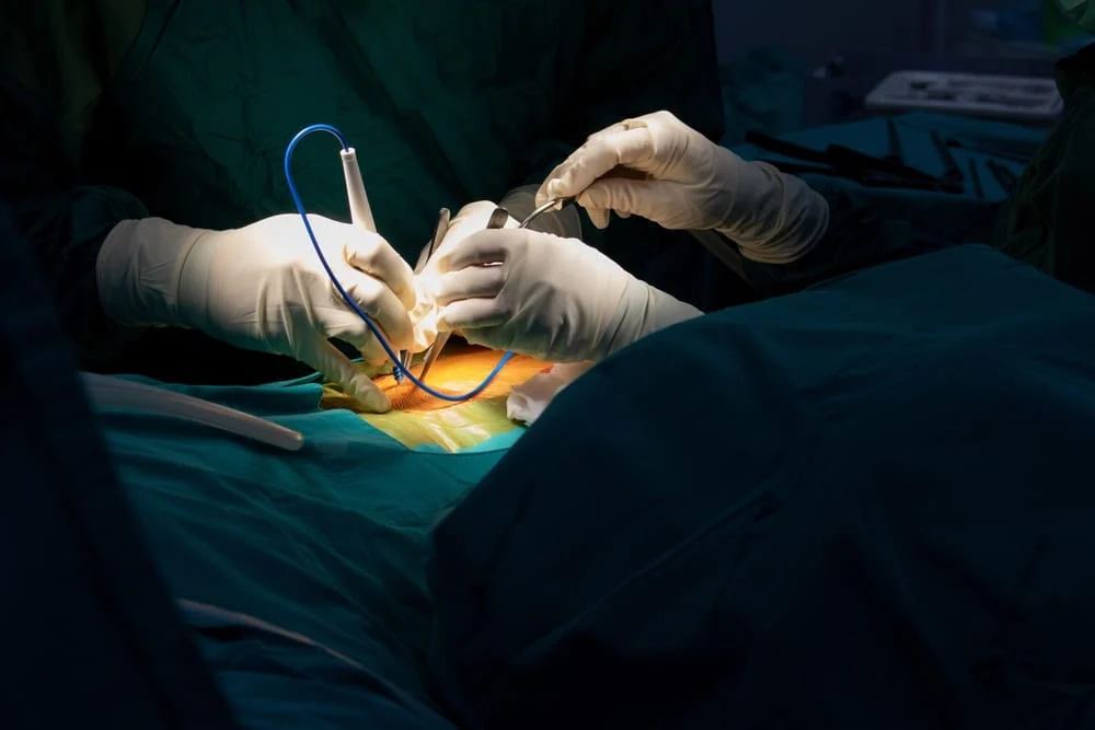 How Does Minimally Invasive Spinal Fusion Compare to Traditional Surgery?