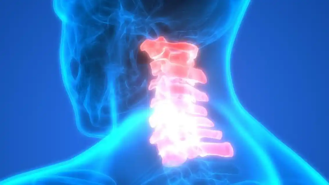 Treatment Options of Cervical Disc Herniation