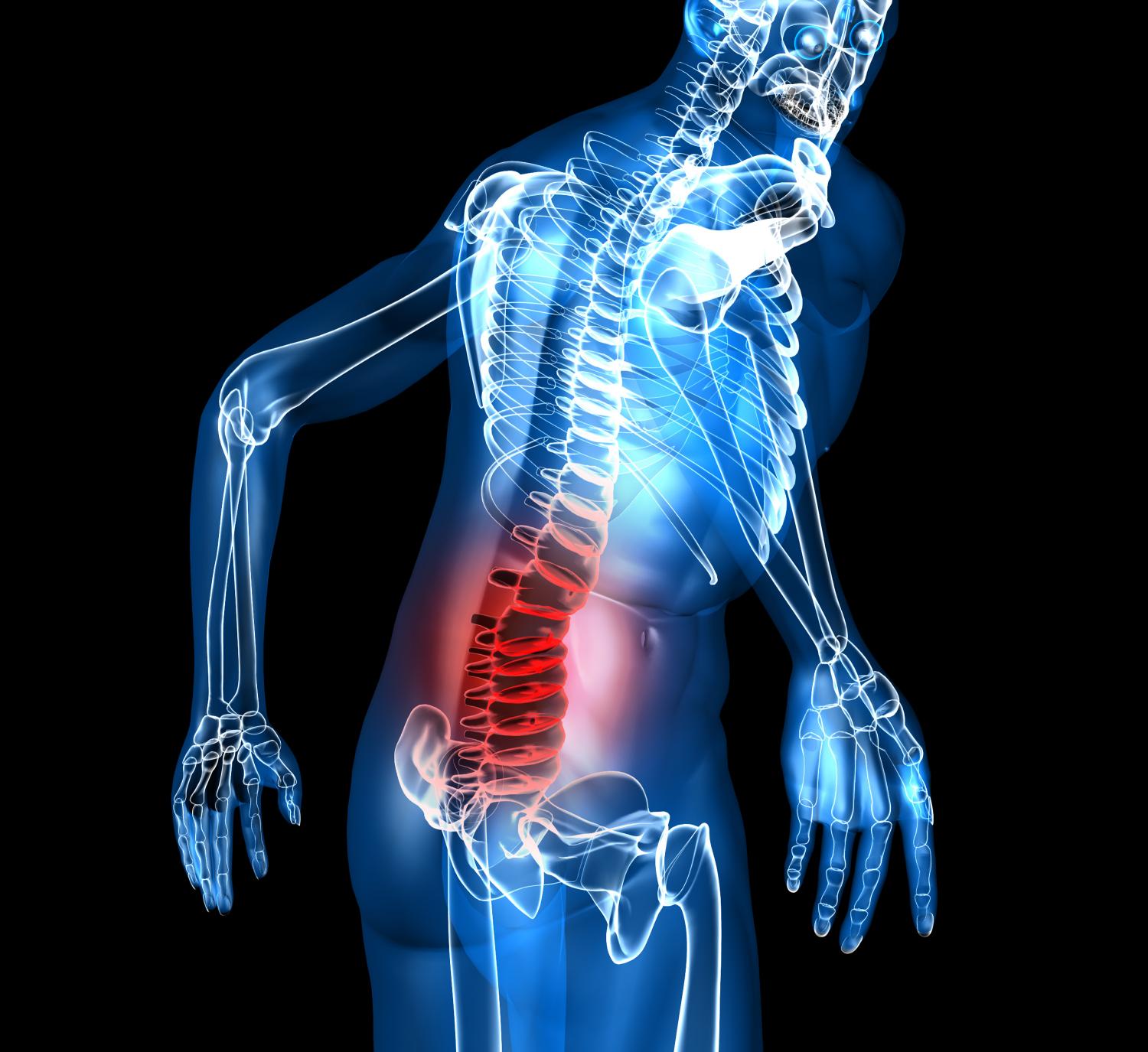 What is Minimally Invasive Spinal Fusion Surgery?