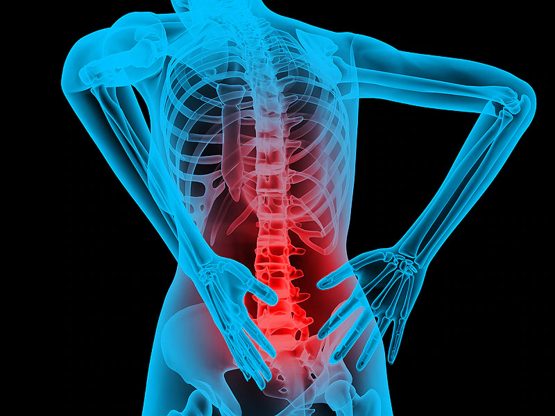 Common Types of Sports-Related Spinal Injuries