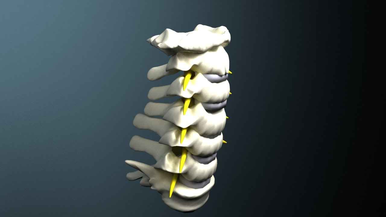 Risks of Basivertebral Nerve Ablation