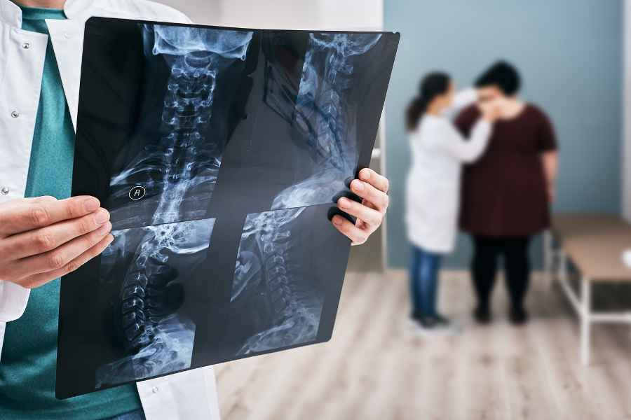 Diagnosis of Spinal Tumors