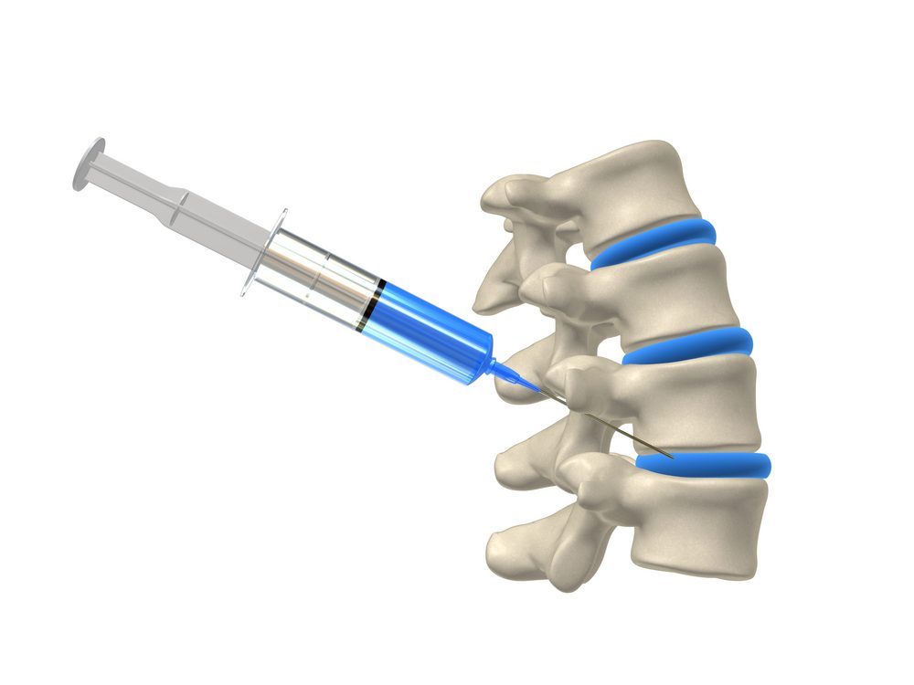 Treatment Options of Spinal Injections for Pain