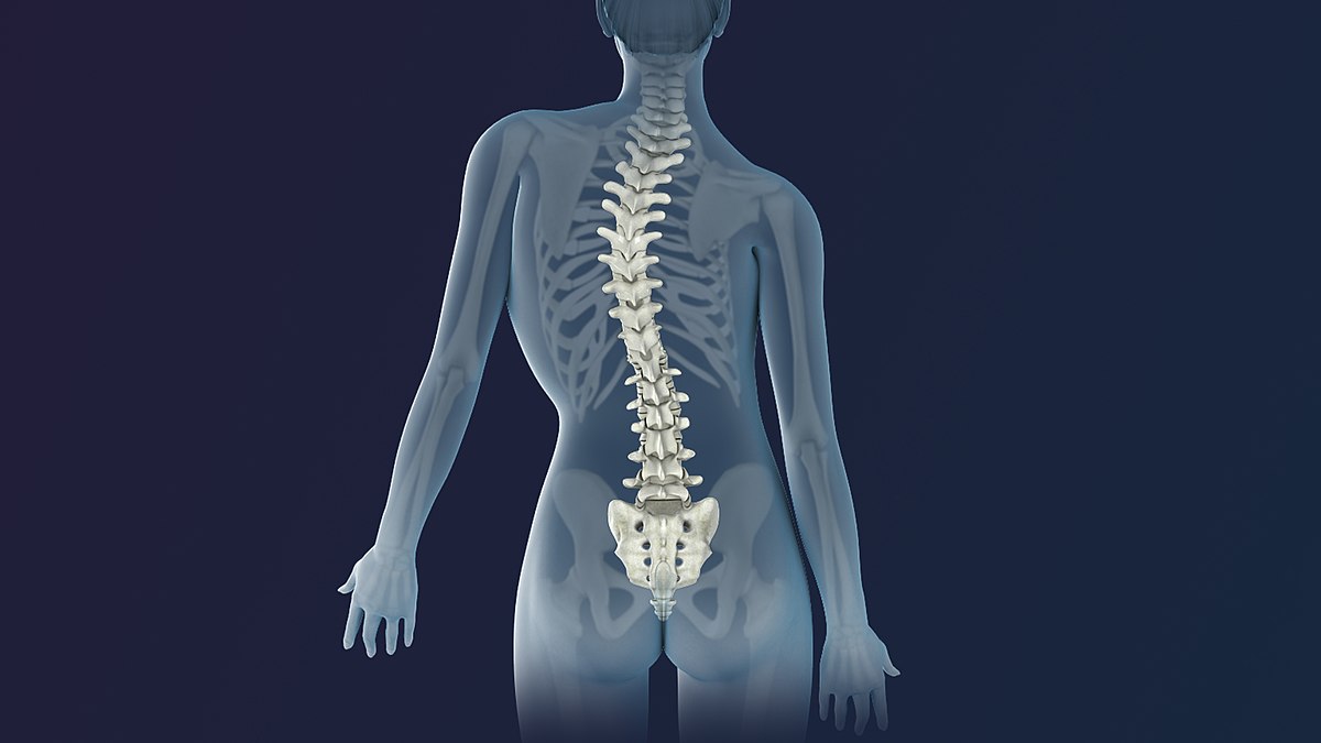 Scoliosis Surgery