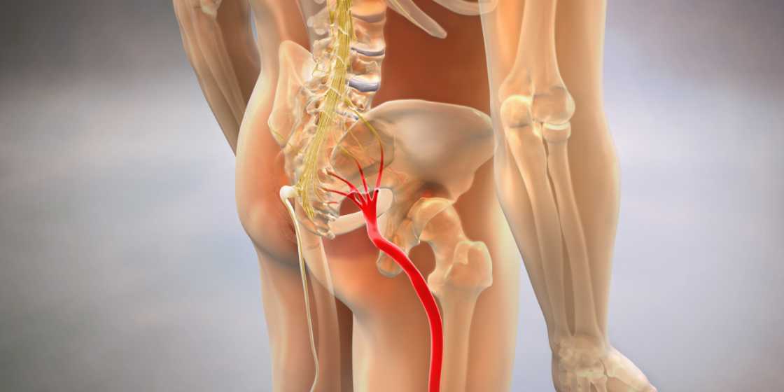 Is Sciatica a Disability?