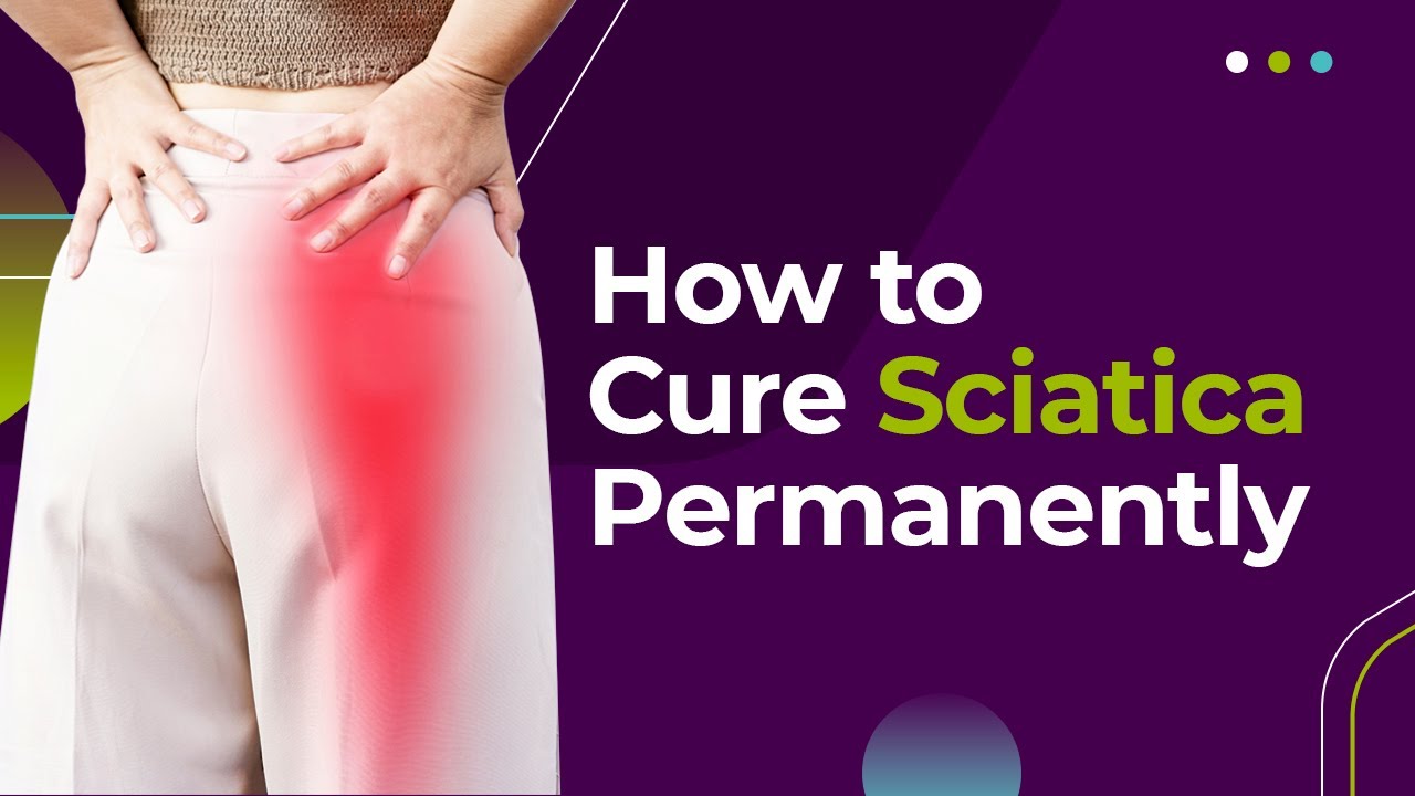 How Long Does Sciatica Last?