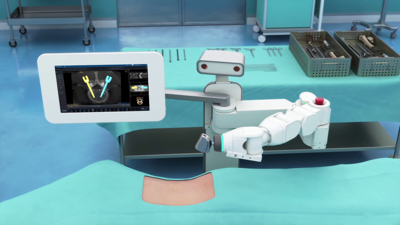How Robotics and AR Are Transforming Spine Surgery?