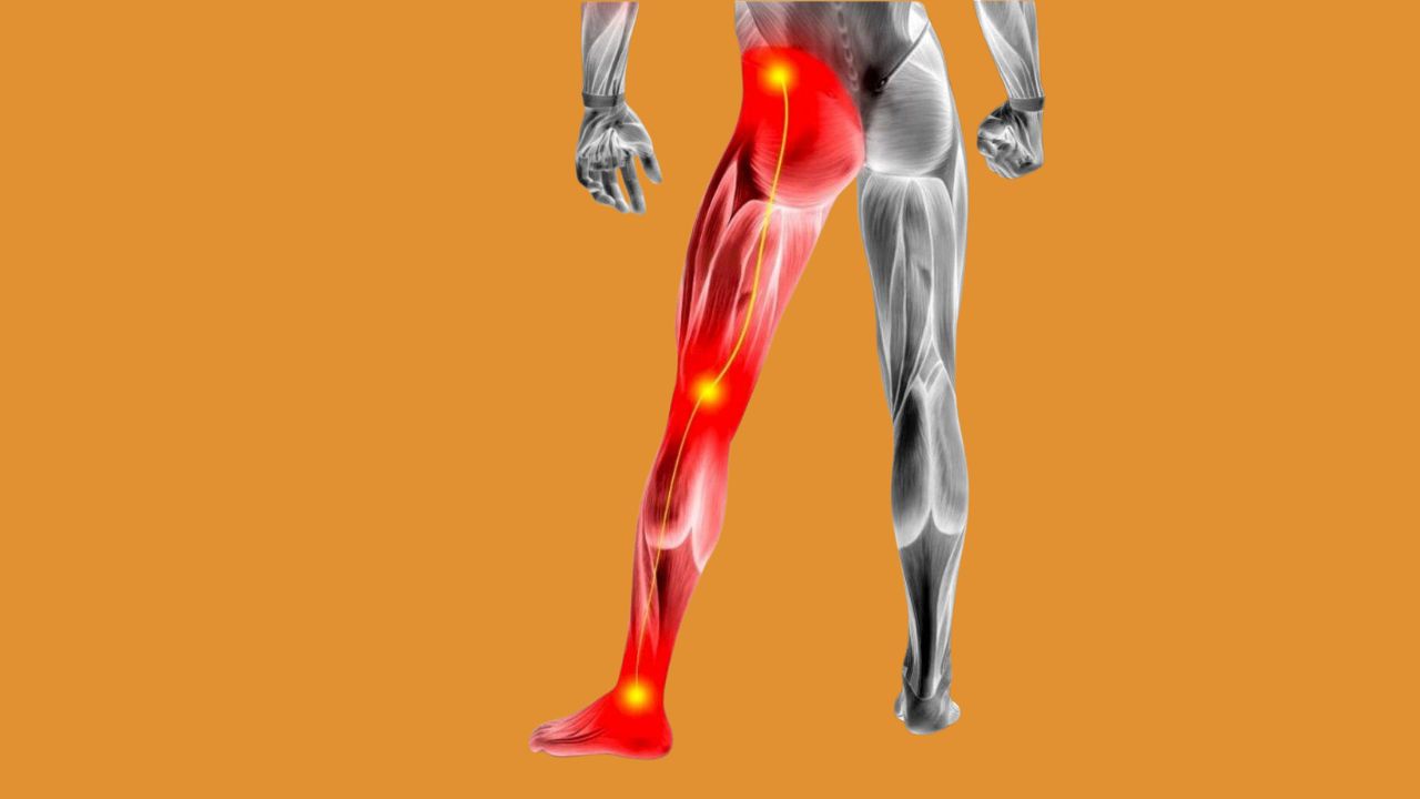 Is Swimming Good for Sciatica?