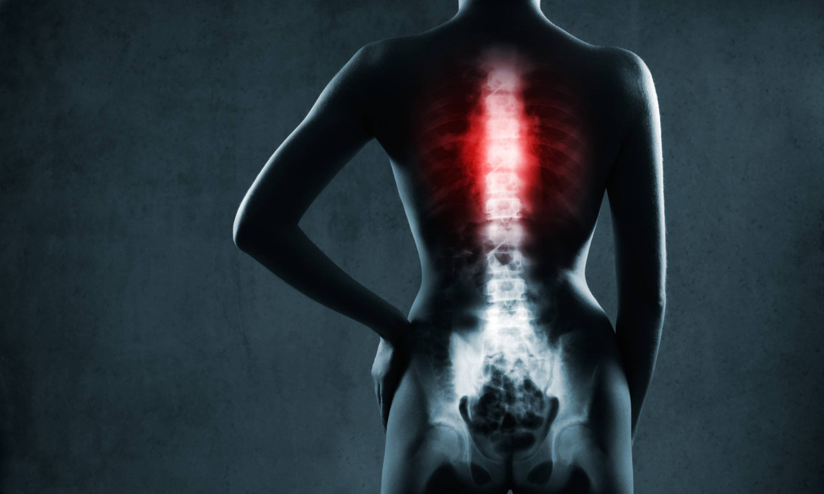 How the UK’s Best Spine Surgeons Perform Complex Spinal Reconstructions