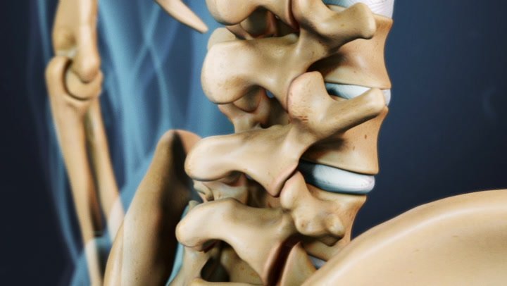 How Serious Is Osteoarthritis of the Spine?