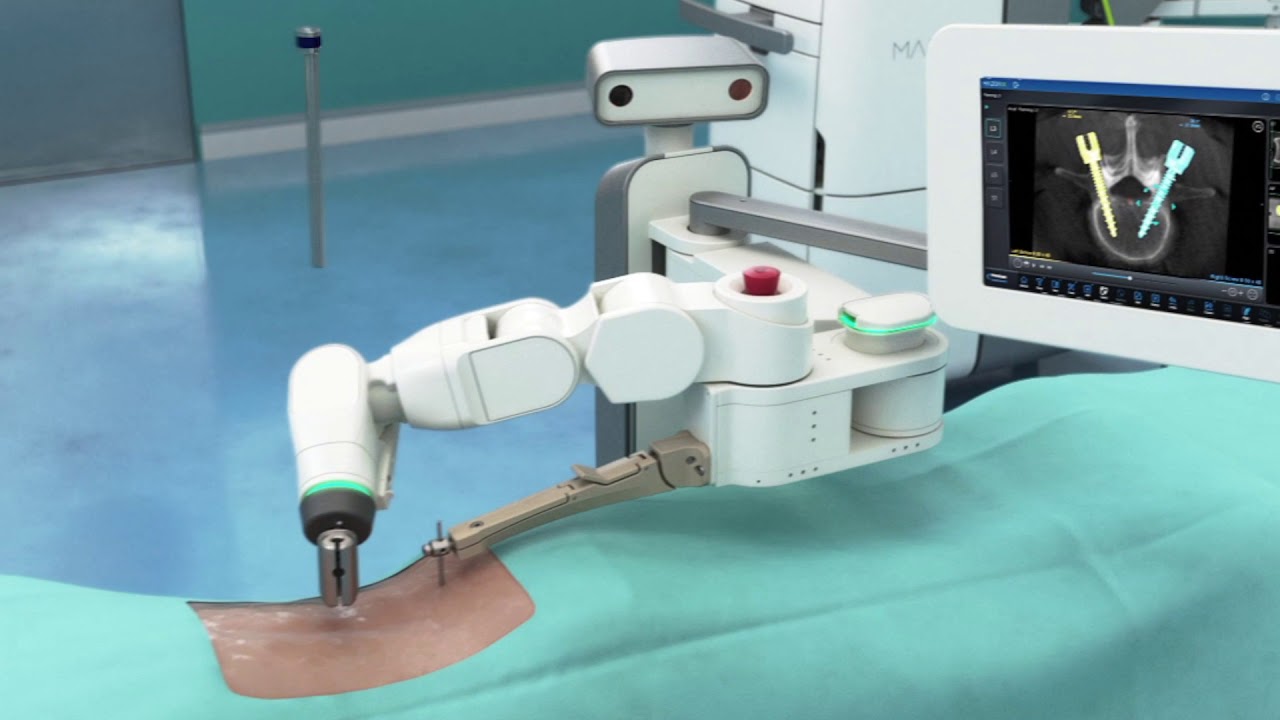 What is Robotic Spine Surgery and How Can it Help Athletes?